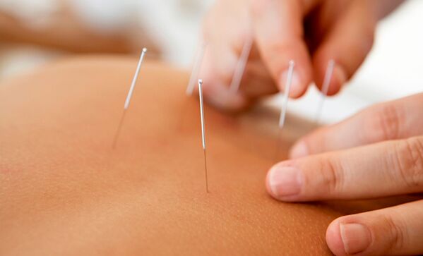 akupunktúra na zvýšenie potencie